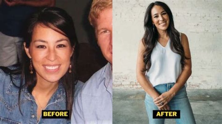 Did Joanna Gaines Have Plastic Surgery Everything You Need To Know My