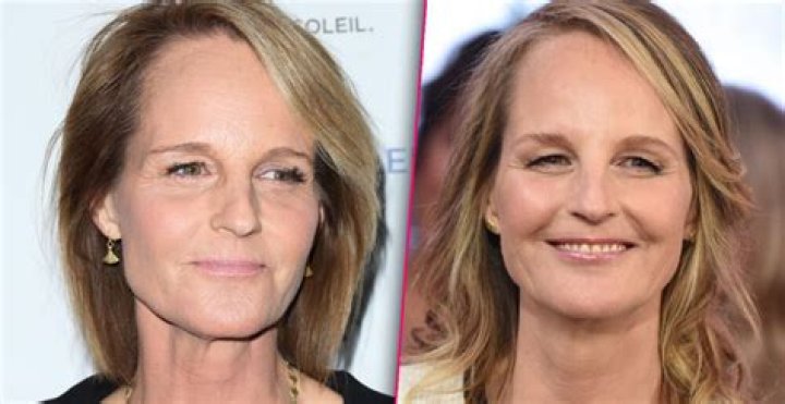 Helen Hunt Erased Her Wrinkles at Age 56 How Did She Do It? Verge Campus