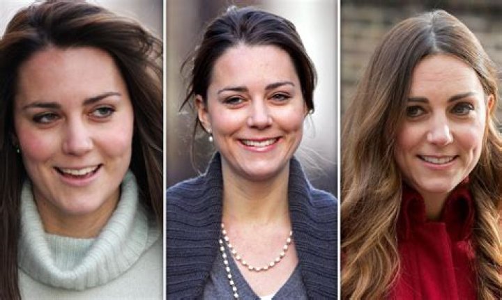 Kate Chastain&rsquo;s Transformation A Look at Her Alleged Plastic Surgery