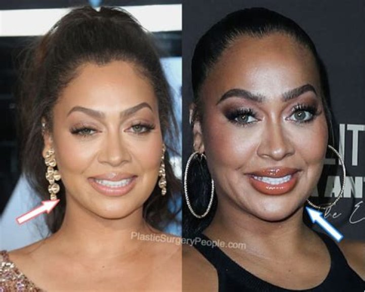 La La Anthony Plastic Surgery and Body Measurements Plastic Surgery Feed