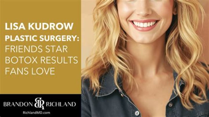 Lisa Helou’s Plastic Surgery Has the Selling the OC Cast Undergone